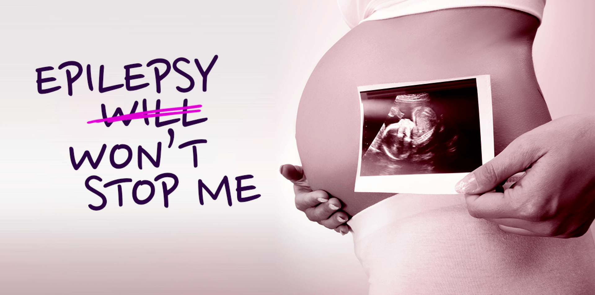 Epilepsy won't stop me. Pregnancy and epilepsy support.