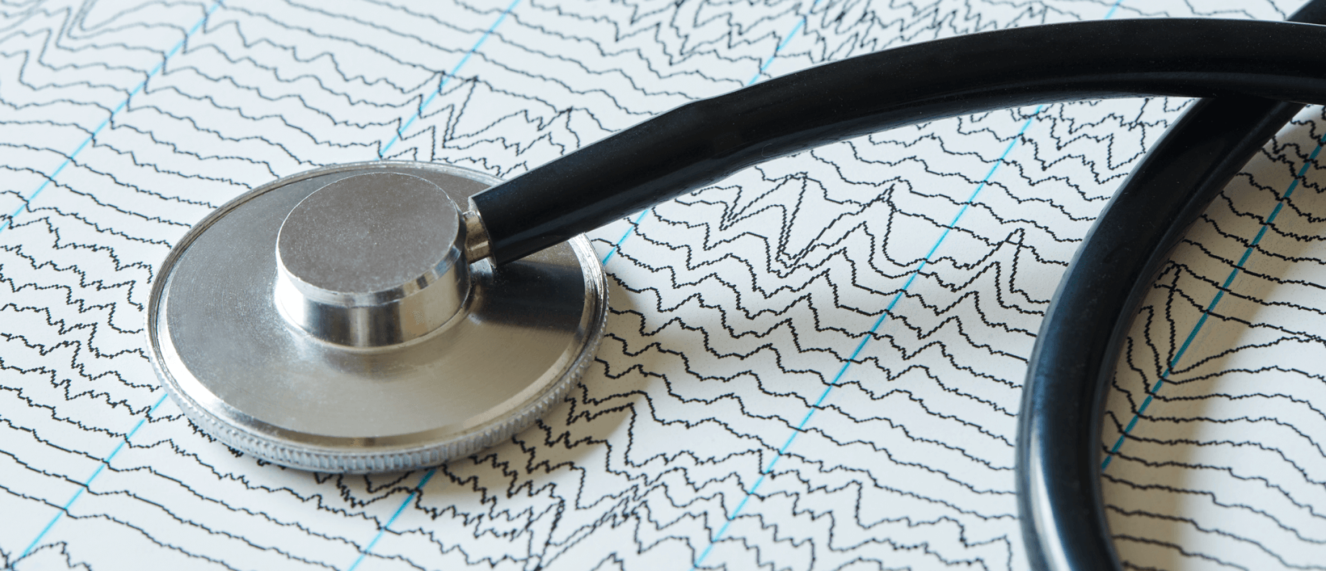 A stethoscope on EEG paper background