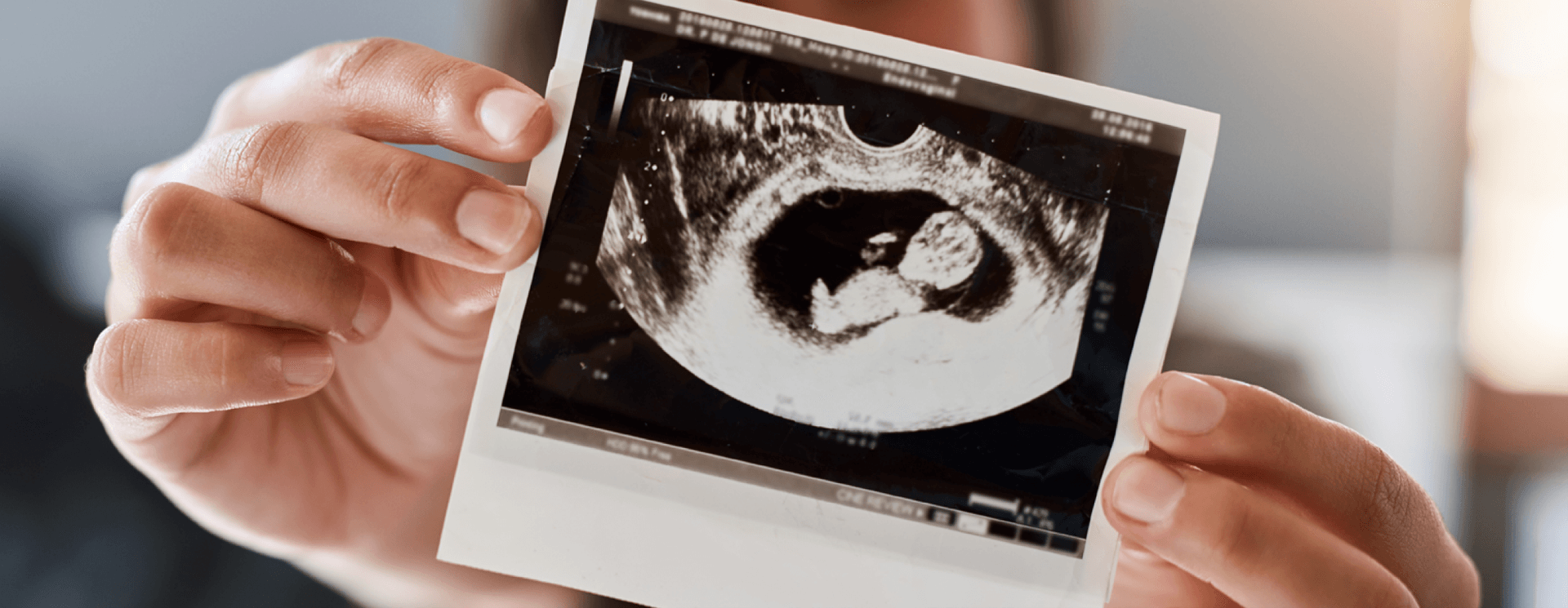 Baby ultrasound photo
